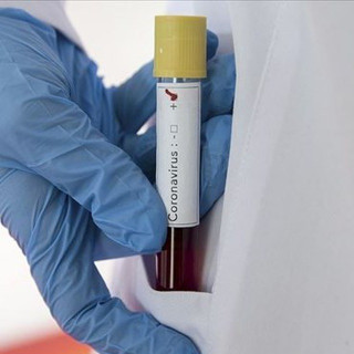 Corona Virüs Türkiye Chat